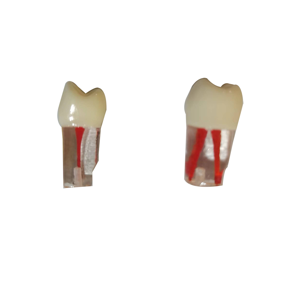 友牙 根管牙粒 tm-406 2颗/袋