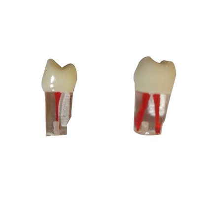 友牙 根管牙粒 tm-406 2颗/袋